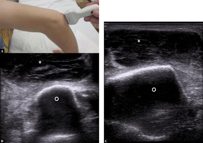 https://cdn.ncbi.nlm.nih.gov/pmc/blobs/3d81/6856779/15ea9d09b305/jou-19-78-212-g006.jpg