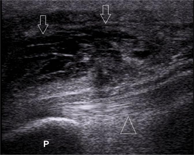 https://cdn.ncbi.nlm.nih.gov/pmc/blobs/3d81/6856779/9736aa4fc122/jou-19-78-212-g002.jpg