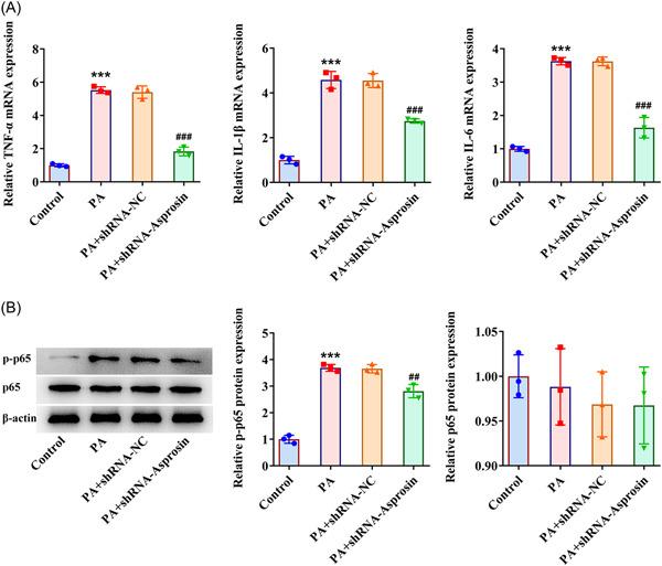 https://cdn.ncbi.nlm.nih.gov/pmc/blobs/3d8b/10436697/2cd47363f4f2/IID3-11-e947-g004.jpg