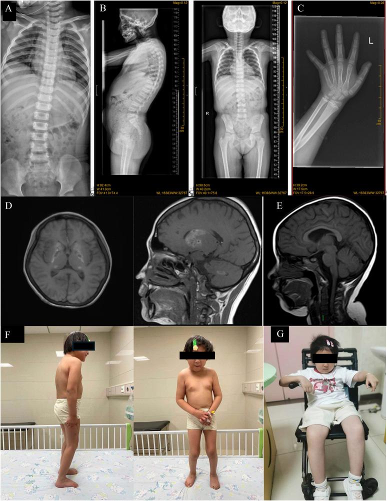 https://cdn.ncbi.nlm.nih.gov/pmc/blobs/3d90/12331710/2ca8b0db6c34/fphar-16-1588003-g001.jpg