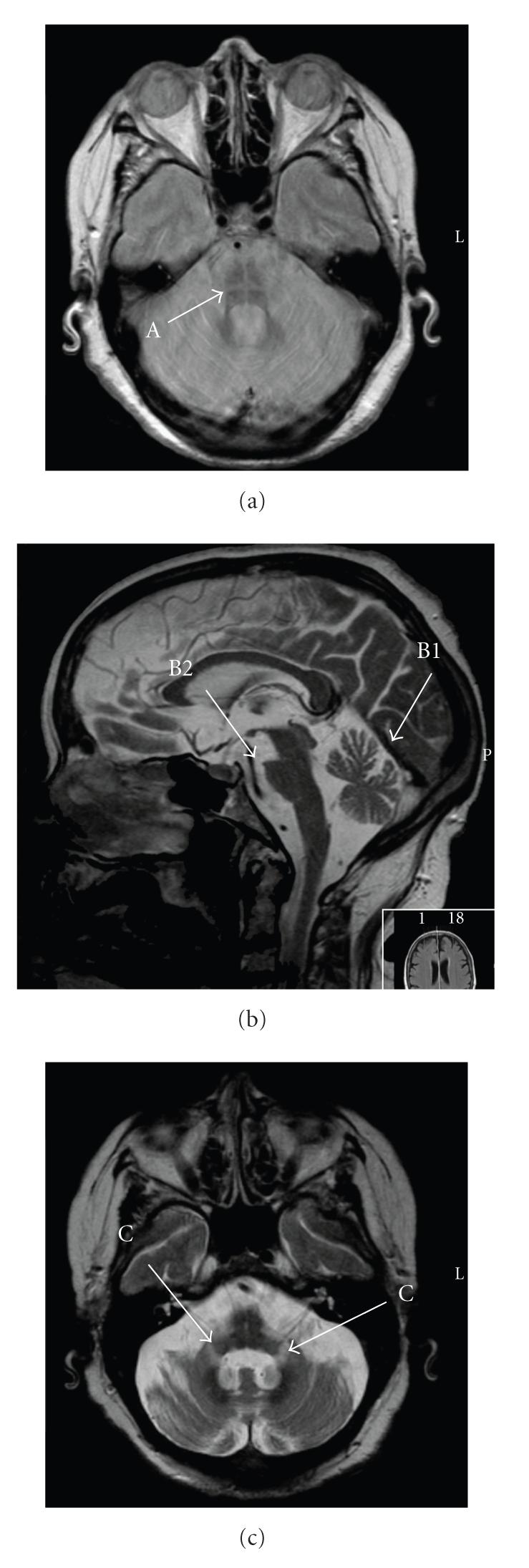 https://cdn.ncbi.nlm.nih.gov/pmc/blobs/3d92/2939431/5b80fc3a0358/CRM2010-351239.001.jpg