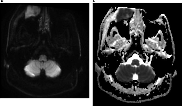 https://cdn.ncbi.nlm.nih.gov/pmc/blobs/3d93/10460950/06873c98e5c8/gr3.jpg