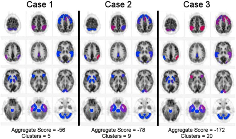 https://cdn.ncbi.nlm.nih.gov/pmc/blobs/3d94/7772456/41e78e76271d/gr2.jpg