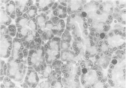https://cdn.ncbi.nlm.nih.gov/pmc/blobs/3d97/1374240/ca3525ad0f01/gut00558-0145-a.jpg