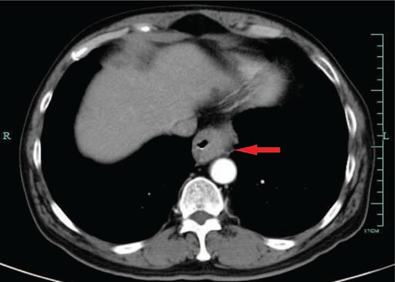 https://cdn.ncbi.nlm.nih.gov/pmc/blobs/3d97/6023669/37591fd35820/medi-97-e11165-g001.jpg