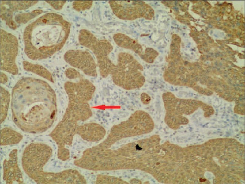 https://cdn.ncbi.nlm.nih.gov/pmc/blobs/3d97/6023669/3fd9e63030bc/medi-97-e11165-g004.jpg