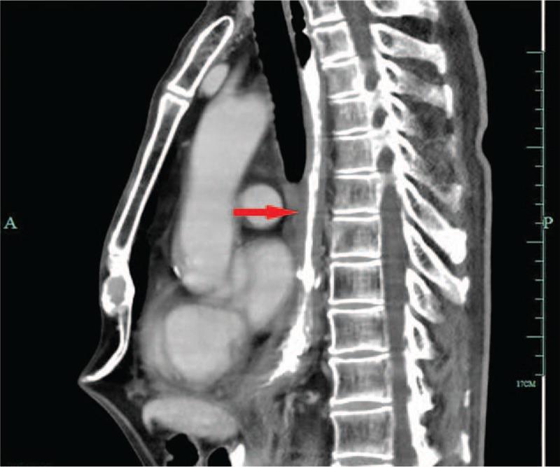 https://cdn.ncbi.nlm.nih.gov/pmc/blobs/3d97/6023669/da082f612407/medi-97-e11165-g006.jpg