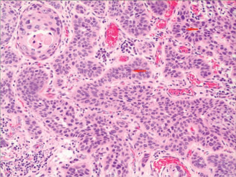 https://cdn.ncbi.nlm.nih.gov/pmc/blobs/3d97/6023669/f7649986e2a5/medi-97-e11165-g002.jpg