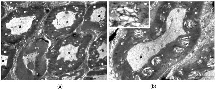 https://cdn.ncbi.nlm.nih.gov/pmc/blobs/3d98/8147170/e0c28b93530a/biomolecules-11-00676-g011a.jpg