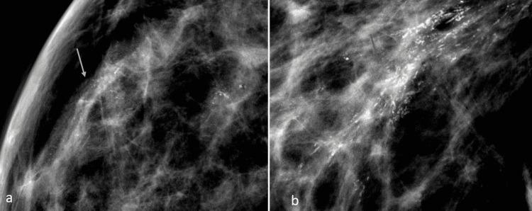 https://cdn.ncbi.nlm.nih.gov/pmc/blobs/3d99/9123400/903f8b634328/cureus-0014-00000024318-i06.jpg