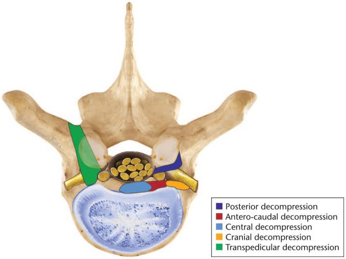 https://cdn.ncbi.nlm.nih.gov/pmc/blobs/3d9e/7845567/99d66eaeb7ef/eor-6-50-g005.jpg