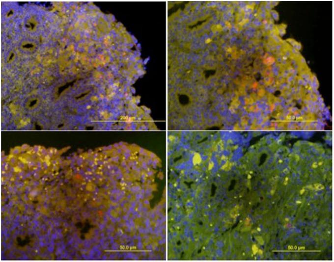https://cdn.ncbi.nlm.nih.gov/pmc/blobs/3d9f/5607922/e348a2b99ee2/10.1177_2055116917731168-fig3.jpg