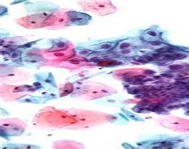 https://cdn.ncbi.nlm.nih.gov/pmc/blobs/3da0/6607241/2ff348bcdaf4/PAMJ-32-148-g002.jpg