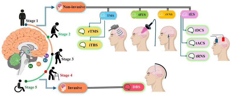 https://cdn.ncbi.nlm.nih.gov/pmc/blobs/3da5/11763832/06ad81162dc2/brainsci-15-00020-g003.jpg
