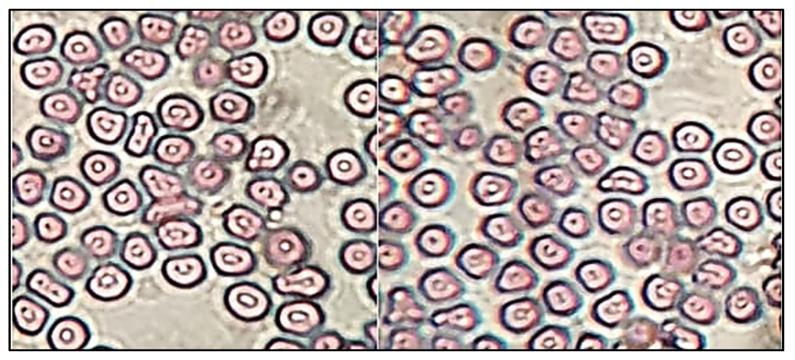https://cdn.ncbi.nlm.nih.gov/pmc/blobs/3da6/8871625/7bc3a6c09779/gels-08-00116-g009.jpg