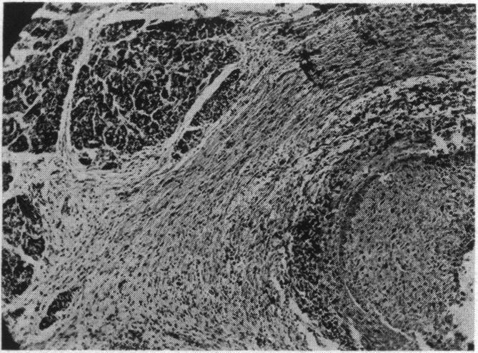 https://cdn.ncbi.nlm.nih.gov/pmc/blobs/3da7/1398232/57a91c930d6f/annsurg00661-0086-b.jpg