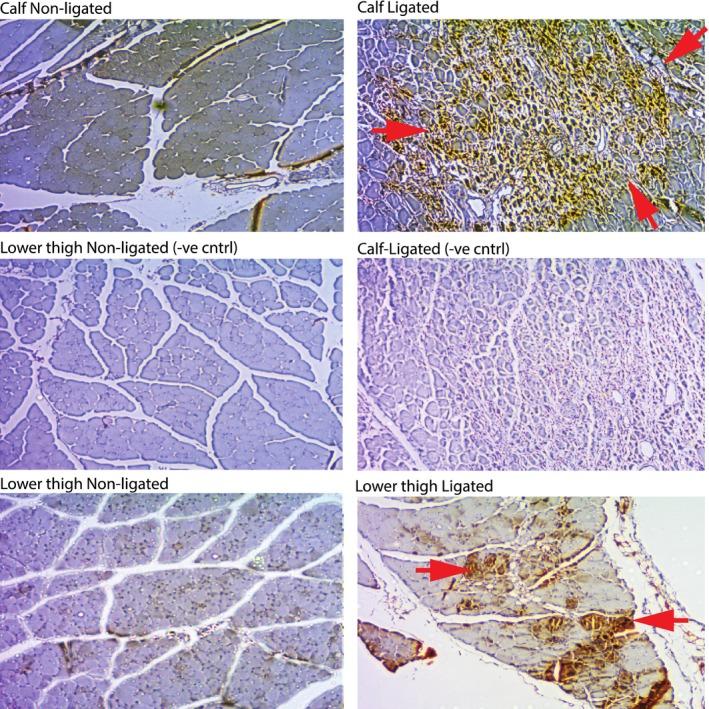 https://cdn.ncbi.nlm.nih.gov/pmc/blobs/3da7/4937238/24a04bb2336c/JAH3-5-e001815-g002.jpg