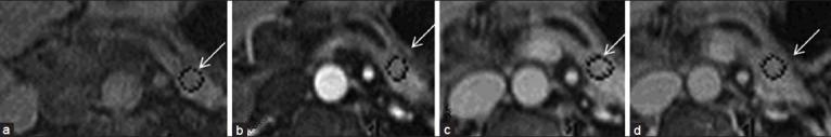 https://cdn.ncbi.nlm.nih.gov/pmc/blobs/3da8/3625885/3a6ea348b360/JCIS-3-7-g010.jpg