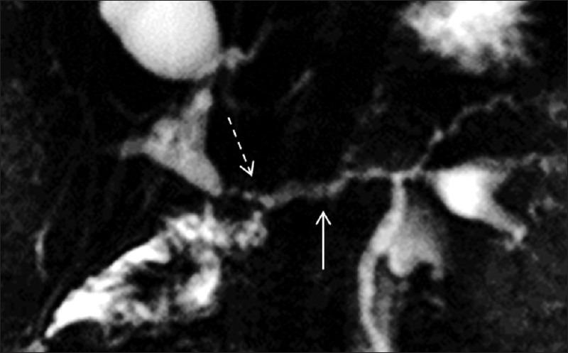 https://cdn.ncbi.nlm.nih.gov/pmc/blobs/3da8/3625885/a2142d96f216/JCIS-3-7-g006.jpg
