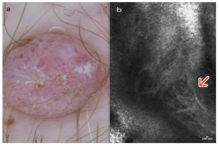 https://cdn.ncbi.nlm.nih.gov/pmc/blobs/3dbc/11394582/2b3308d383b3/cancers-16-02972-g005.jpg