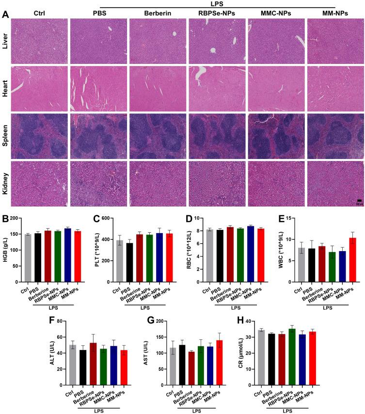 https://cdn.ncbi.nlm.nih.gov/pmc/blobs/3dbd/12087599/8f7e5248dd36/IJN-20-6163-g0007.jpg