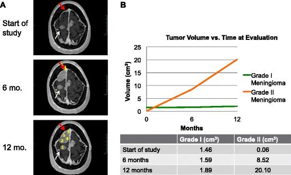 https://cdn.ncbi.nlm.nih.gov/pmc/blobs/3dc8/5307647/c2a972328d2f/12885_2017_3127_Fig1_HTML.jpg