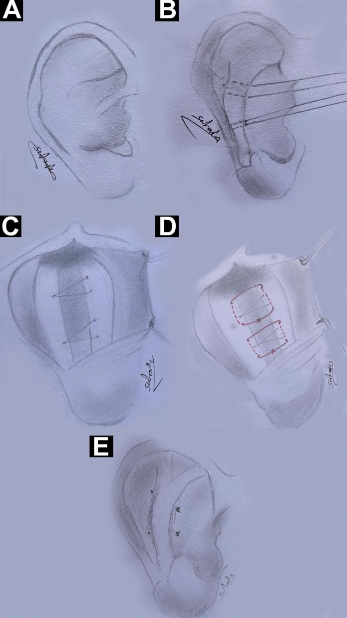 https://cdn.ncbi.nlm.nih.gov/pmc/blobs/3dc9/11893691/cac670f9aceb/266_2024_4478_Fig1_HTML.jpg