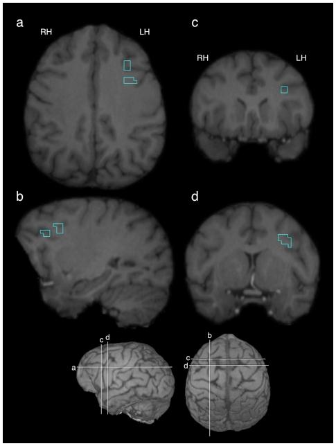 https://cdn.ncbi.nlm.nih.gov/pmc/blobs/3dca/3080370/49f8e784688b/pone.0018852.g001.jpg