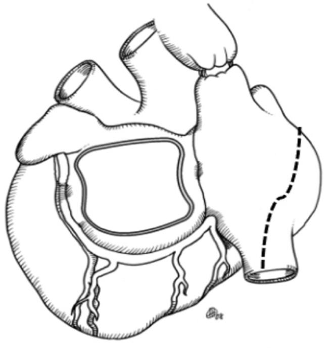 https://cdn.ncbi.nlm.nih.gov/pmc/blobs/3dce/9390713/a61032ed5e6b/gr4.jpg