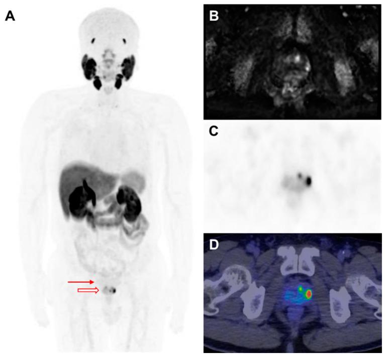 https://cdn.ncbi.nlm.nih.gov/pmc/blobs/3dd4/12109171/0acc8793784f/biomedicines-13-01132-g003.jpg