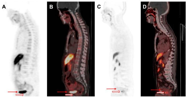 https://cdn.ncbi.nlm.nih.gov/pmc/blobs/3dd4/12109171/3ef9527c419c/biomedicines-13-01132-g002.jpg