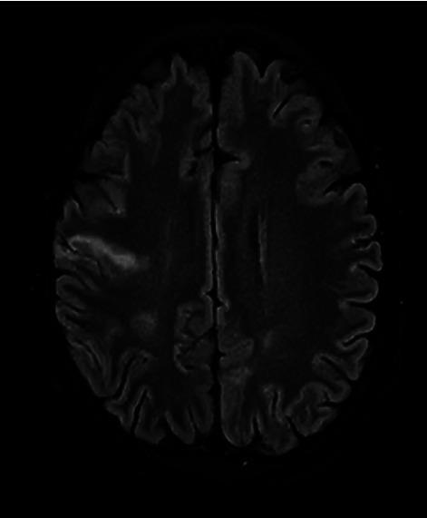 https://cdn.ncbi.nlm.nih.gov/pmc/blobs/3dd5/10247318/41086fd864a2/CRIID2023-7405556.001.jpg