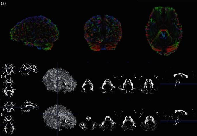 https://cdn.ncbi.nlm.nih.gov/pmc/blobs/3dd8/11919035/afab4033dc41/DA2024-5595912.002.jpg