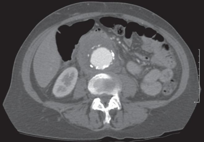 https://cdn.ncbi.nlm.nih.gov/pmc/blobs/3ddb/4644006/8873daedb3d1/cjidmm-26-249-1.jpg