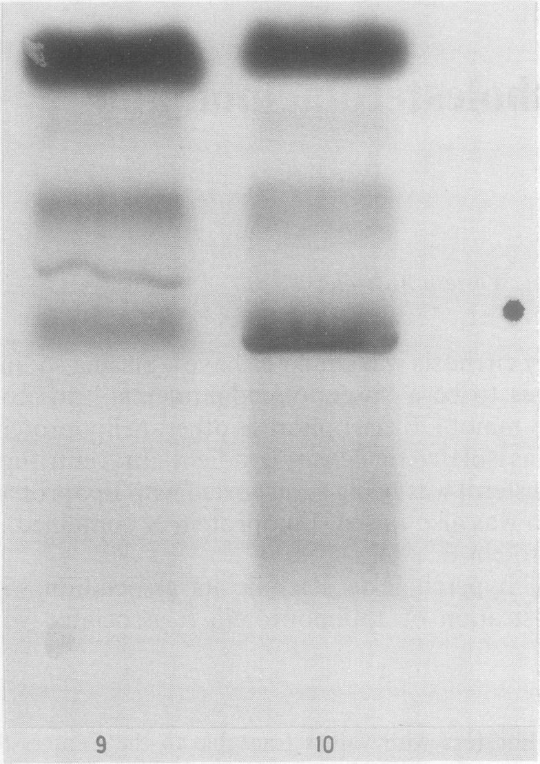 https://cdn.ncbi.nlm.nih.gov/pmc/blobs/3de3/1141820/2960d7266433/jclinpath00346-0052-a.jpg