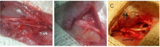 https://cdn.ncbi.nlm.nih.gov/pmc/blobs/3de5/5879904/e2670f65cebf/NRR-13-309-g006.jpg