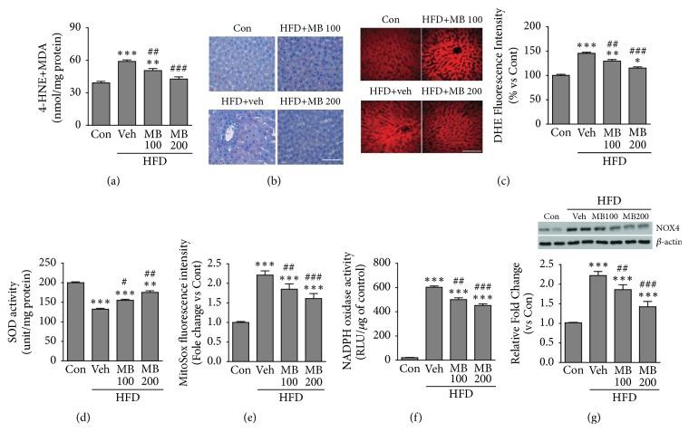 https://cdn.ncbi.nlm.nih.gov/pmc/blobs/3de8/6311263/956c259c2d15/ECAM2018-8165716.004.jpg