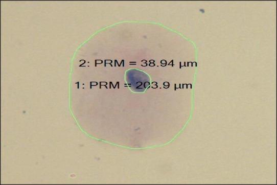https://cdn.ncbi.nlm.nih.gov/pmc/blobs/3def/4995868/504f937213b0/JCytol-33-125-g001.jpg