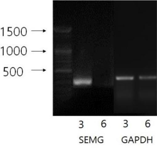 https://cdn.ncbi.nlm.nih.gov/pmc/blobs/3def/6985293/0662b11ff1ea/dr-23-4-355-g4.jpg