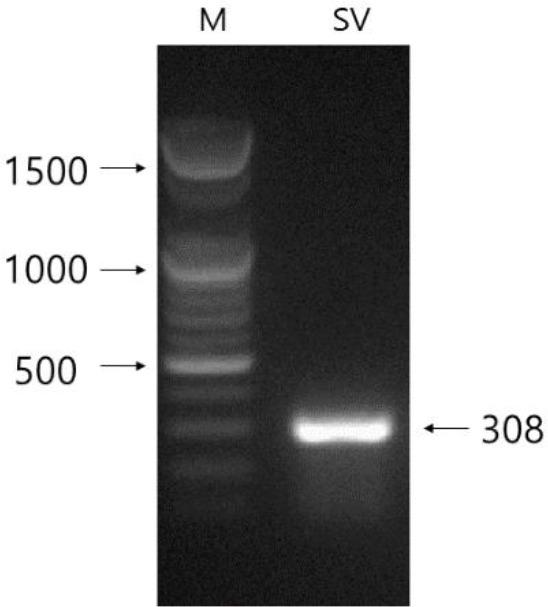 https://cdn.ncbi.nlm.nih.gov/pmc/blobs/3def/6985293/cd9a26a67783/dr-23-4-355-g1.jpg