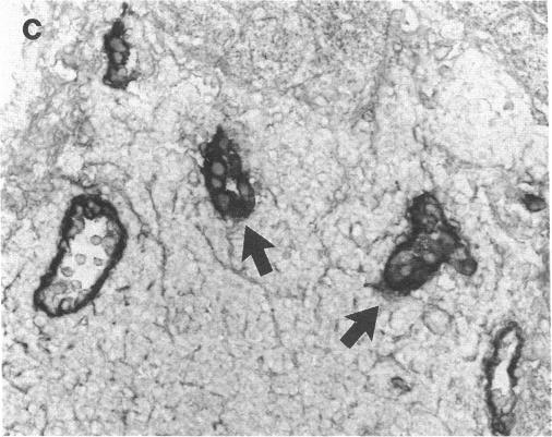 https://cdn.ncbi.nlm.nih.gov/pmc/blobs/3df3/288436/6986586e1378/jcinvest00043-0433-c.jpg