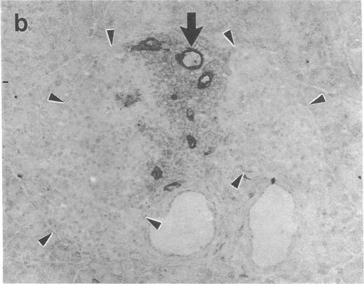https://cdn.ncbi.nlm.nih.gov/pmc/blobs/3df3/288436/9f29a17c6a68/jcinvest00043-0433-b.jpg
