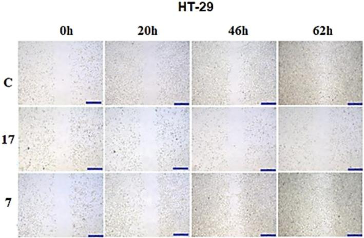 https://cdn.ncbi.nlm.nih.gov/pmc/blobs/3e03/12056219/061d79dd27a4/CBDD-105-e70120-g003.jpg