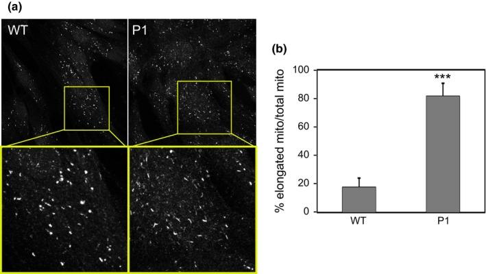 https://cdn.ncbi.nlm.nih.gov/pmc/blobs/3e03/7057109/076fc35131f9/MGG3-8-e1121-g003.jpg