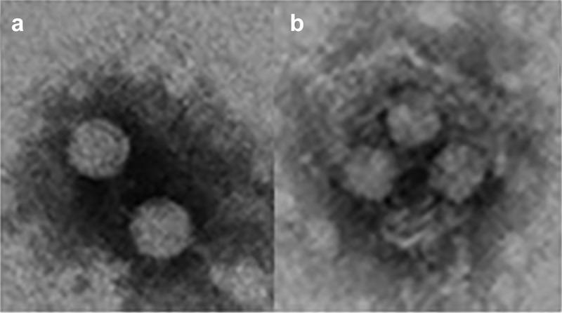 https://cdn.ncbi.nlm.nih.gov/pmc/blobs/3e05/8043188/bf296ace1eaa/KVIR_A_1910442_F0002_B.jpg
