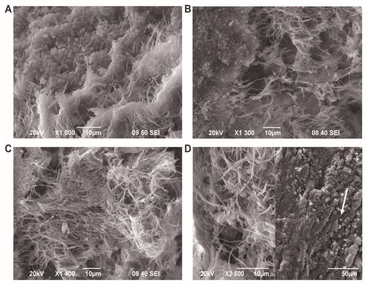 https://cdn.ncbi.nlm.nih.gov/pmc/blobs/3e0a/10778237/47e299bfb7b9/cells-13-00043-g010.jpg