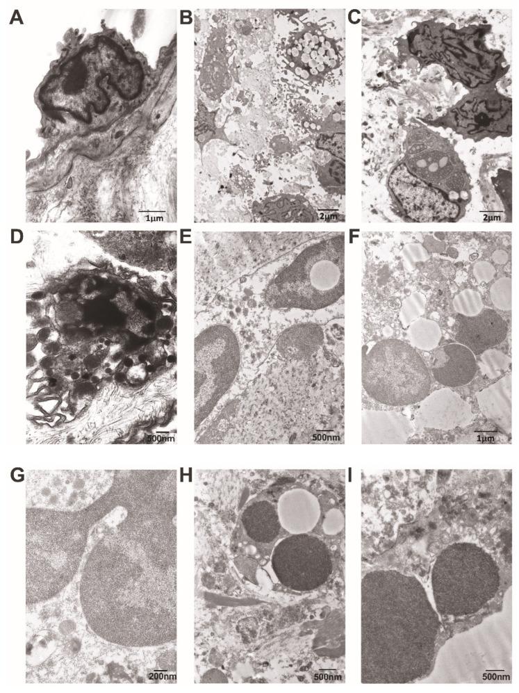 https://cdn.ncbi.nlm.nih.gov/pmc/blobs/3e0a/10778237/7c202e0eaa52/cells-13-00043-g009.jpg