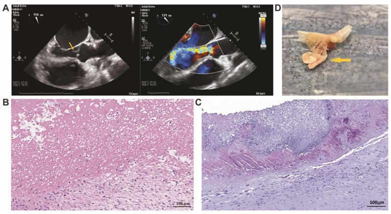 https://cdn.ncbi.nlm.nih.gov/pmc/blobs/3e0a/10778237/d23216319677/cells-13-00043-g001.jpg