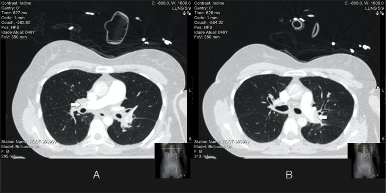 https://cdn.ncbi.nlm.nih.gov/pmc/blobs/3e0b/9987011/d8776641801a/rbti-34-04-0524-g01.jpg