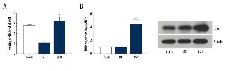 https://cdn.ncbi.nlm.nih.gov/pmc/blobs/3e0d/6743380/75925d3c0a9f/medscimonit-25-6639-g002.jpg